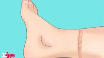 ألم الكاحل: وداعًا للمعاناة مع هذه الحلول المنزلية السهلة وغير المكلفة